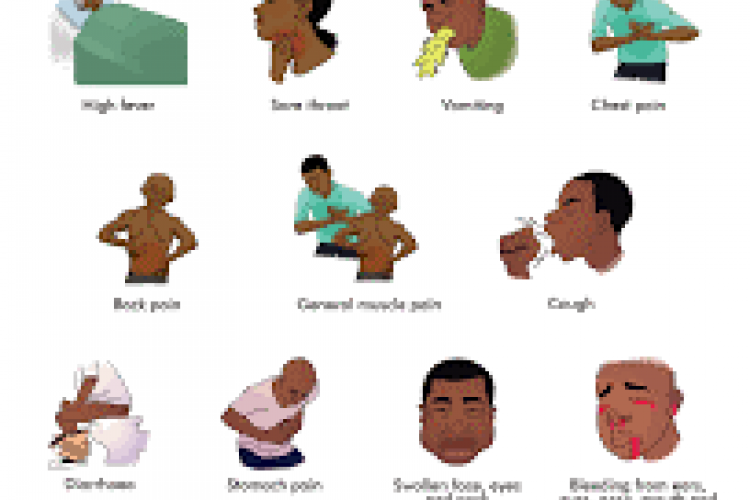 Lassa Fever Symptoms